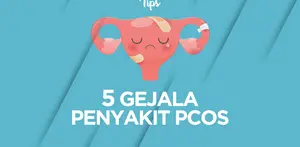 5 Gejala Penyakit PCOS yang Bikin Wanita Susah Hamil
