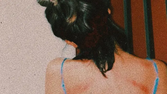 Marion Jola pamer punggung bekas kerokan (https://www.instagram.com/p/CAxxu7mJBmr/)