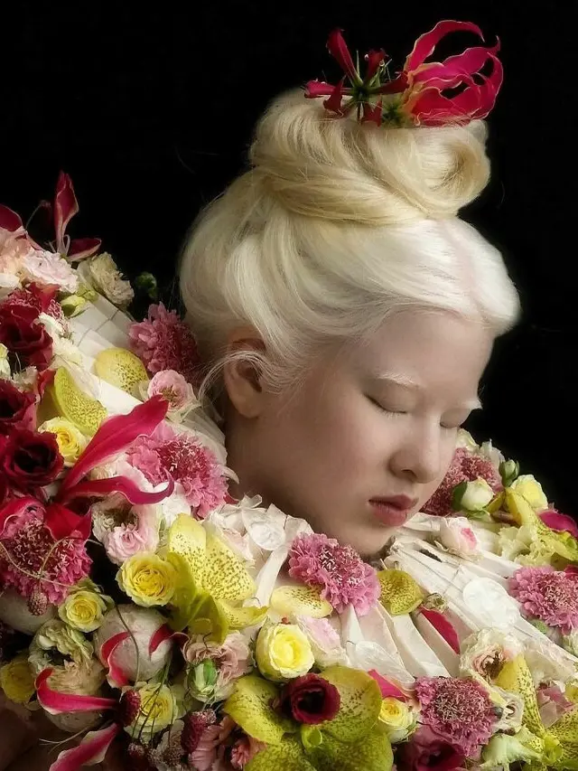 Dibuang ke Panti Asuhan Karena Albino, Ini 6 Potret Xueli Kini Sukses Jadi Model. (Sumber: Instagram/xueli_a)