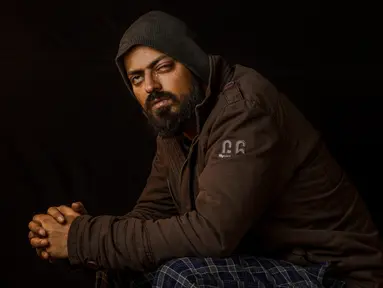 Wartawan foto, Xuhaib Maqbool (30) berpose di Srinagar, Kashmir, India 1 Desember 2016. Meski menunjukkan kameranya wartawan ini tetap menjadi korban senapan angin yang menghilangkan mata kirinya. (AP Photo / Bernat Armangue)