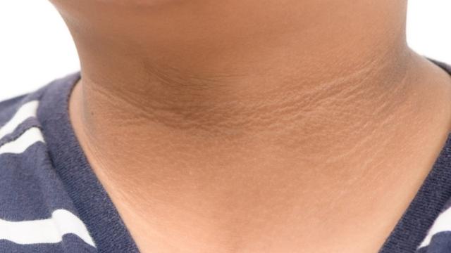 Masalah Kesehatan, 7 Perubahan pada Tubuh Anda Ini Harus Diperhatikan