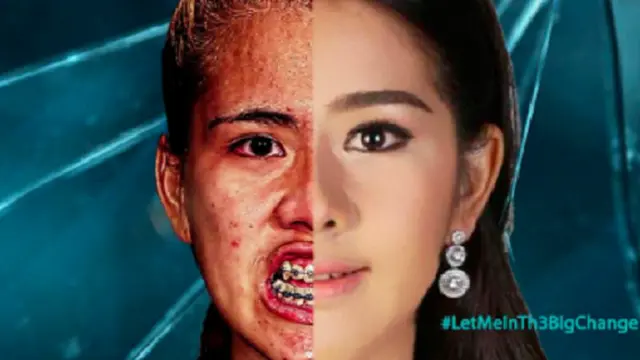 [Bintang] Operasi plastik