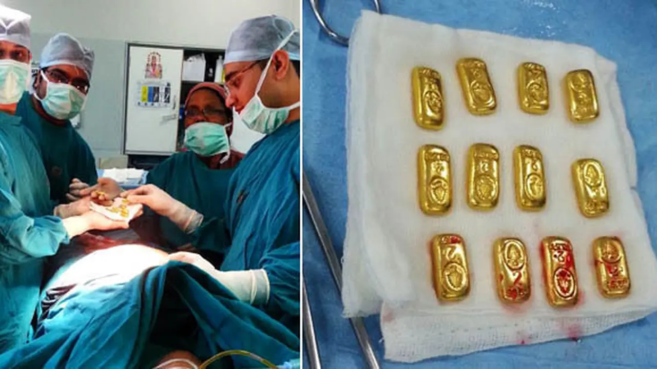 Tim dokter setelah mengeluarkan emas | Foto: copyright dailymail.co.uk