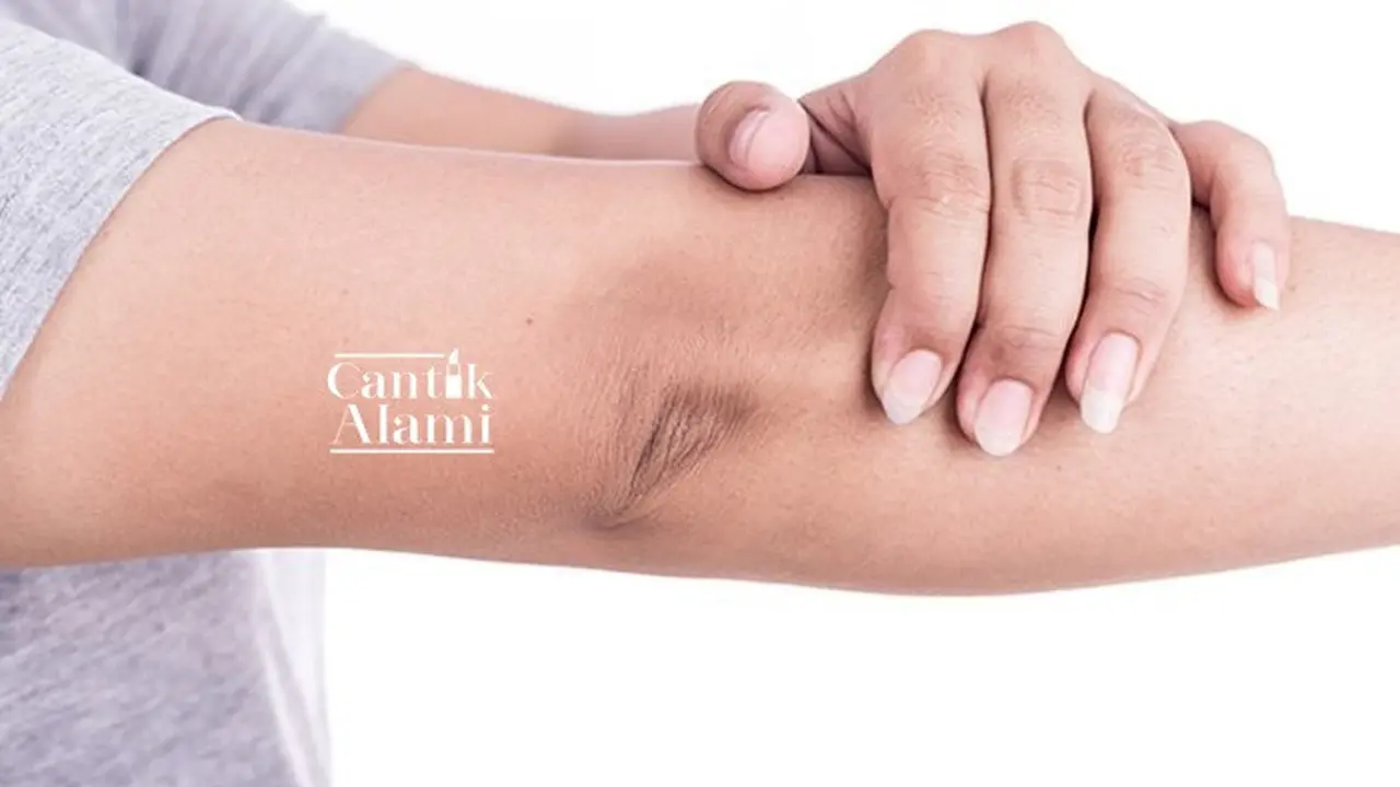 Cantik Alami: Siku Hitam Bikin Nggak Pede? Begini Cara Mencerahkannya