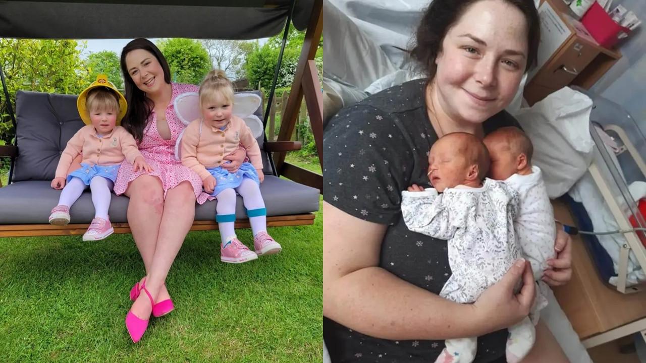 Kehamilan Superfetasi