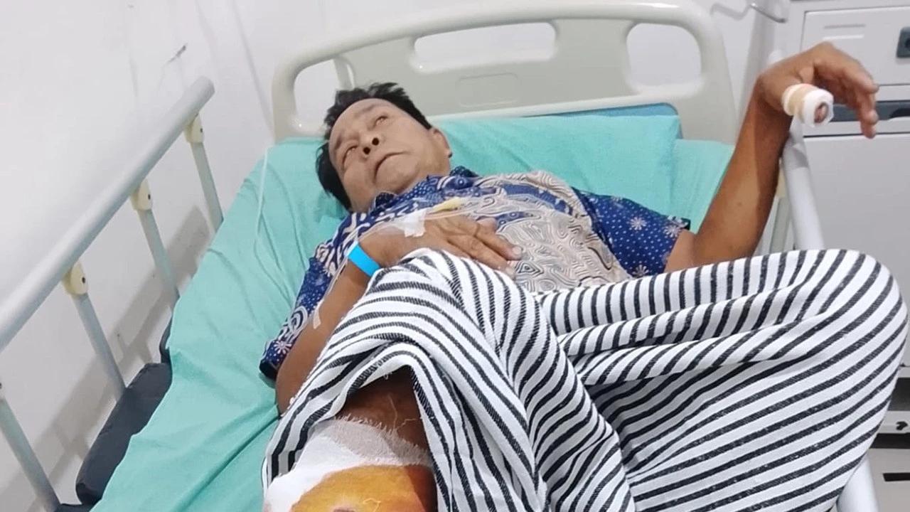 Tubuh Petani Ini Penuh Luka Akibat Digigit dan Dicakar Beruang saat Menyadap Karet, Selamat Usai Menyabetkan Golok