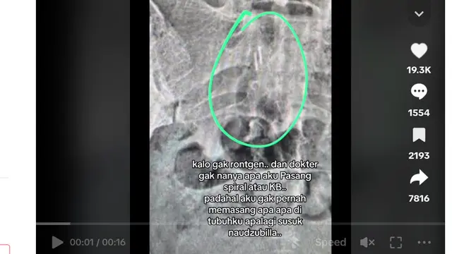 Stevie Agnecya Meninggal Dunia, Sempat Ungkap Dikirimi Santet