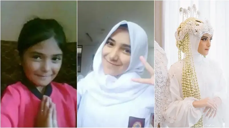7 Potret Transformasi Nadya Mustika, Pernah Dititipkan 10 Tahun di Panti Asuhan
