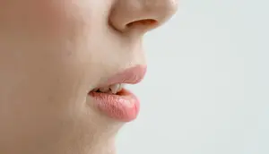 6 Cara Mengatasi Bibir Kering Secara Permanen, Jangan Asal Pilih Lip Balm