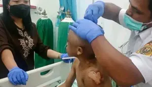 Bocah Kakak Beradik di Sidikalang Jadi Korban Penyiksaan Sadis