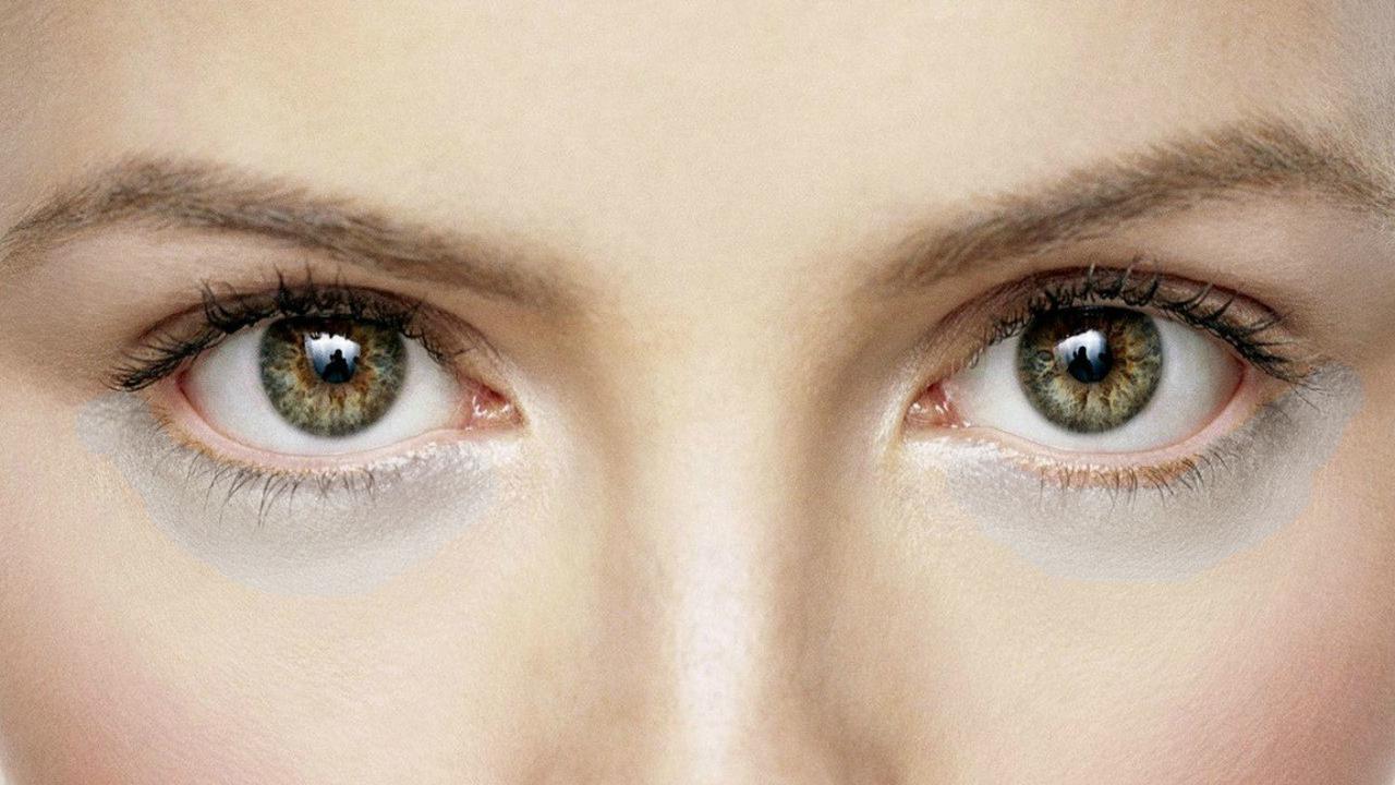 Punya Mata Panda? Atasi dengan Cara Ini