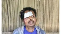 Bastian Mau (50), warga Desa Oelpuah, Kabupaten  Kupang, NTT, nyaris dibakar hidup-hidup oleh warga karena dituduh sebagai  dukun santet alias sihir.