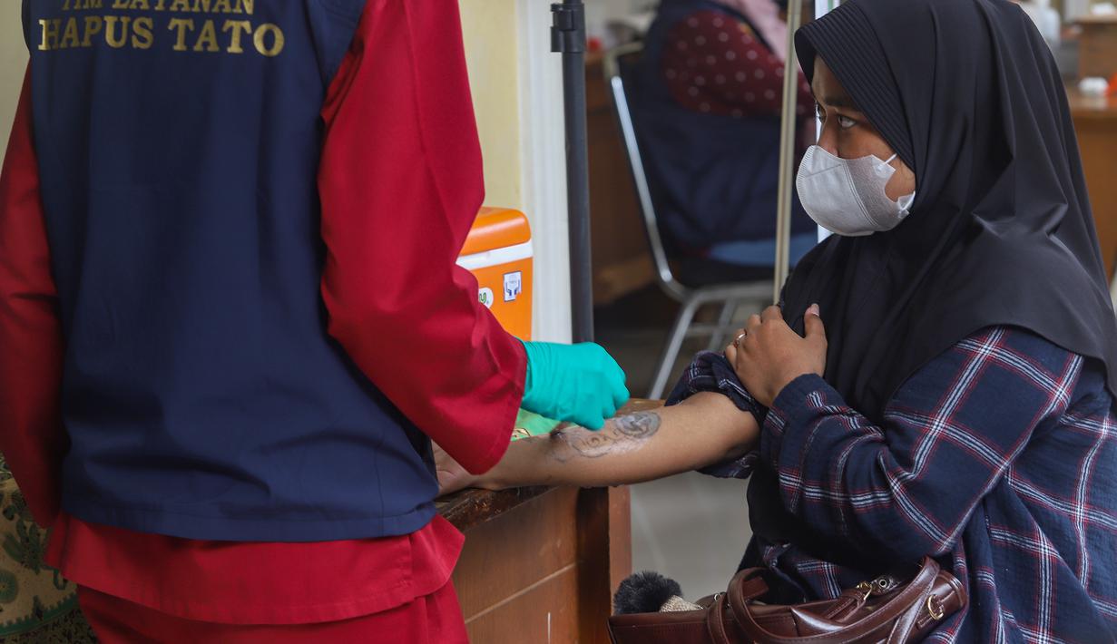 Untuk mengikuti program ini, calon peserta wajib mengisi formulir pendaftaran secara lengkap serta melampirkan fotokopi KTP dan foto tato yang ingin dihapus. Tampak dalam foto, petugas melakukan proses hapus tato pada tubuh peserta di Masjid Sunda Kelapa, Jakarta, Selasa (24/2/2026). (merdeka.com/Arie Basuki)