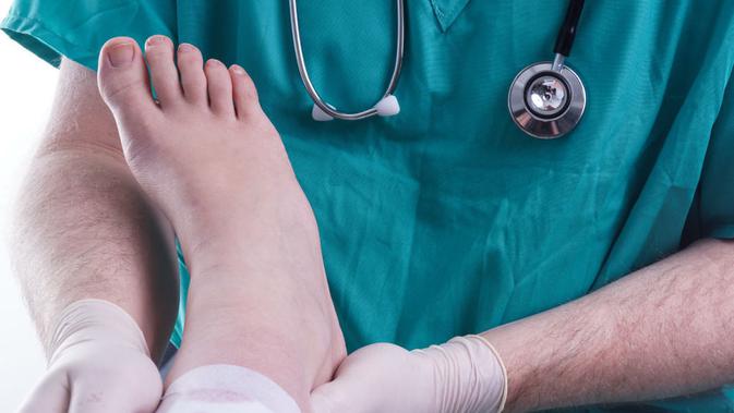 Apakah Luka Diabetes Bisa Disembuhkan