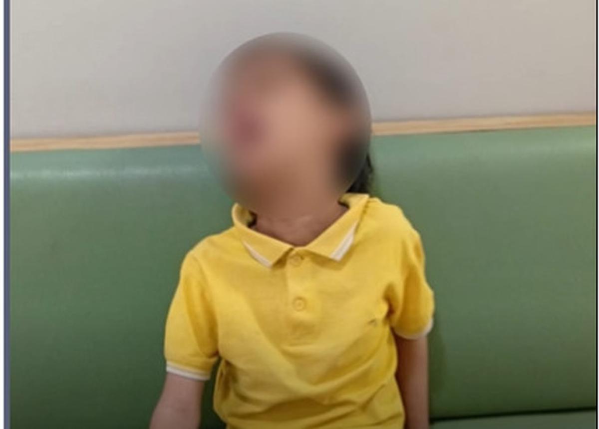 Bocah disabilitas tewas diduga dibullying tetangga di surabaya. (istimewa).