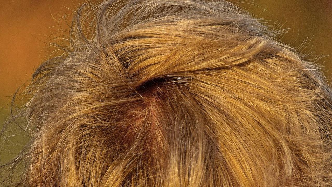 Cara Mengatasi Bau Rambut Lainnya