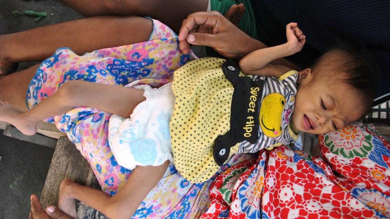 Badan Balita Ini Makin Hari Makin Menyusut