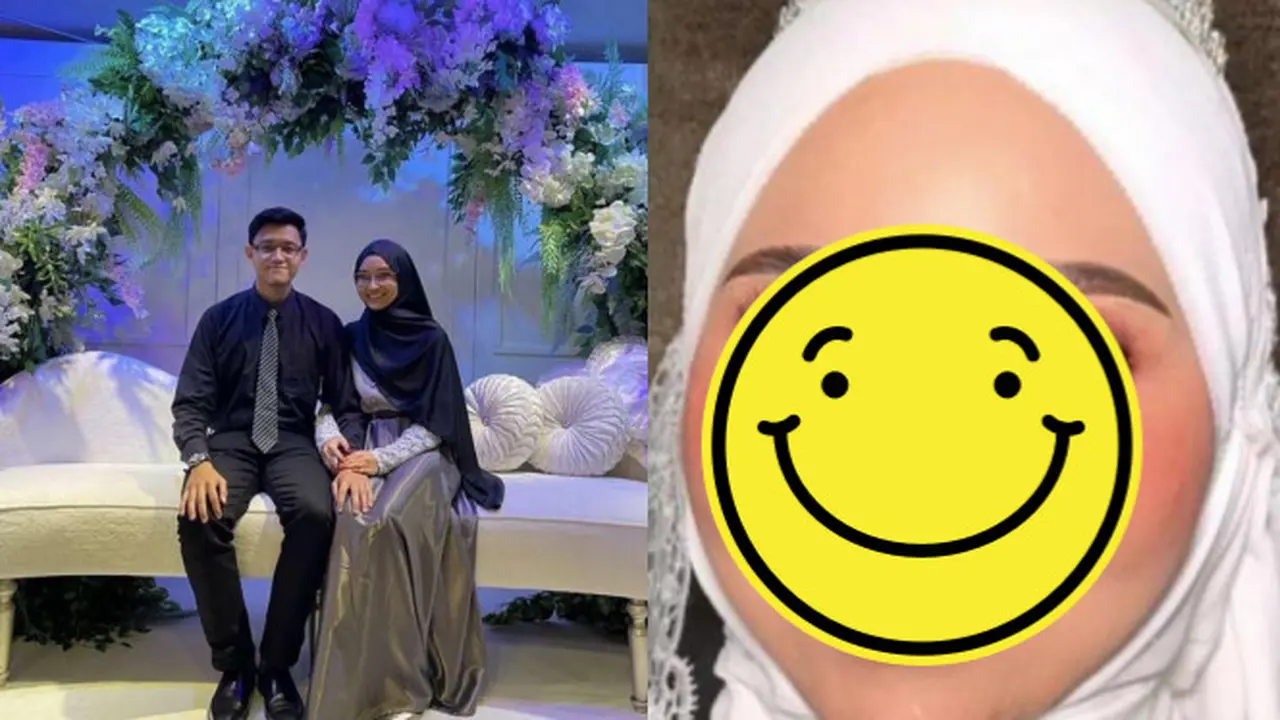 Berkat Makeup, Pengantin dengan Luka Di Wajah Bikin Pangling di Pernikahan