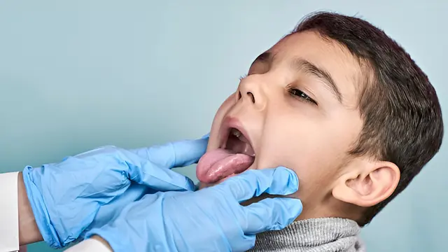 Seorang anak laki-laki menjulurkan lidahnya ketika diperiksa oleh dokter (Foto Dok: Freepik/user19622617)
