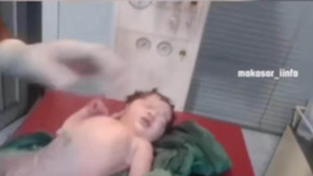 Bayi Baru Lahir Ditampar Berkali-kali oleh Dokter Malah Dipuji Netizen, Ternyata ini yang Terjadi