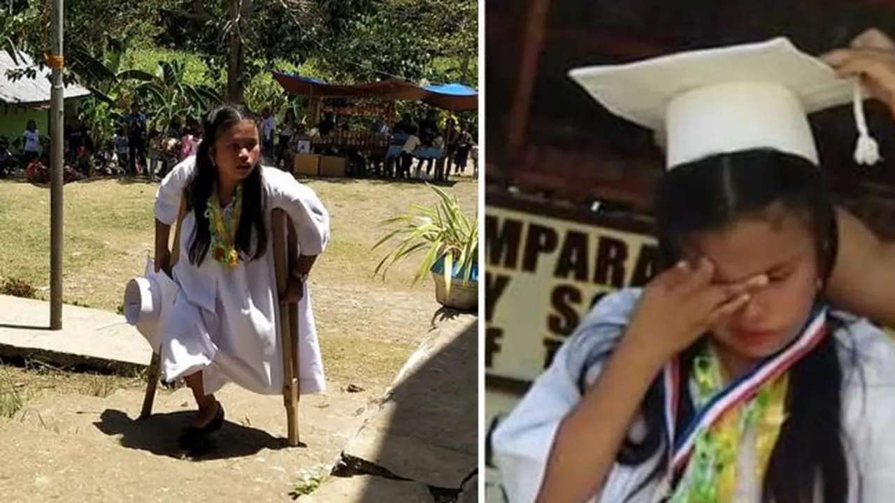 Kisah Jean Arija Daipal tempuh 2 km dengan satu kaki demi bisa sekolah