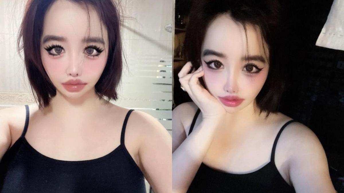 Park Bom Bantah Pernyataan Agensi soal Kesehatannya: Saya Baik-Baik Saja