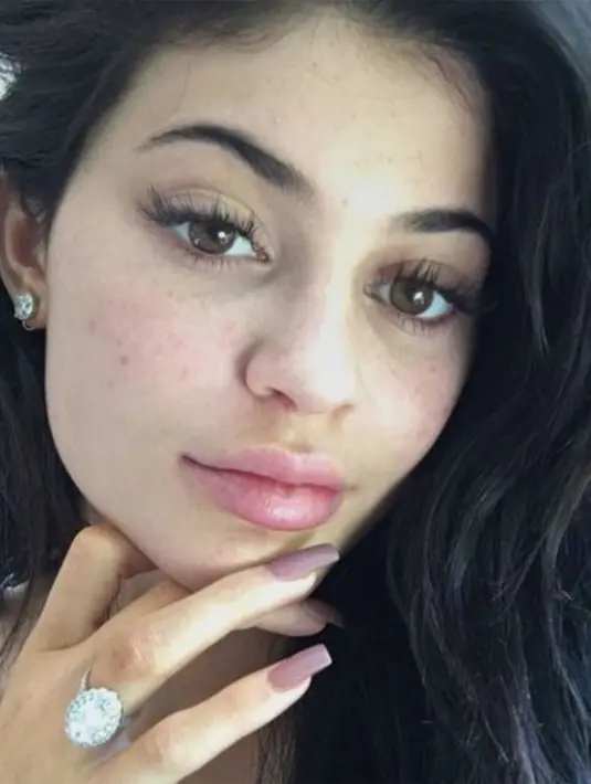 Tak malu dengan wajah yang dihiasi freckless, Kylie Jenner tetap saja cantik ya! (instagram/kyliejenner)