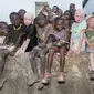 Bagian tubuh orang albino dipercaya dapat membawa kekayaan, kebahagiaan, dan keberuntungan (Amnesty/CNN).