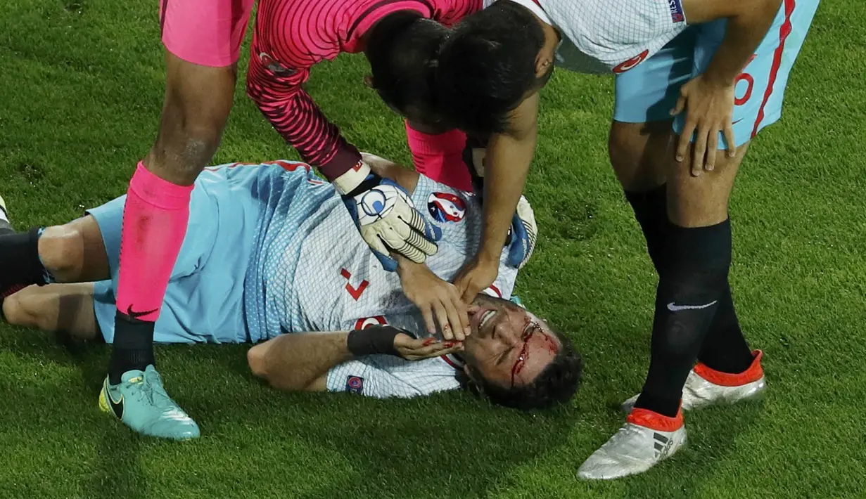 Kepala Pemain Turkey, Gokhan Gonul  berdarah akibat benturan saat berduel dengan pemain republik Ceska pada lanjutan grup D Euro Cup 2016 di Stadion Bollaert-Delelis, Lens (22/6/2016) dini hari WIB.  (REUTERS/Benoit Tessier)