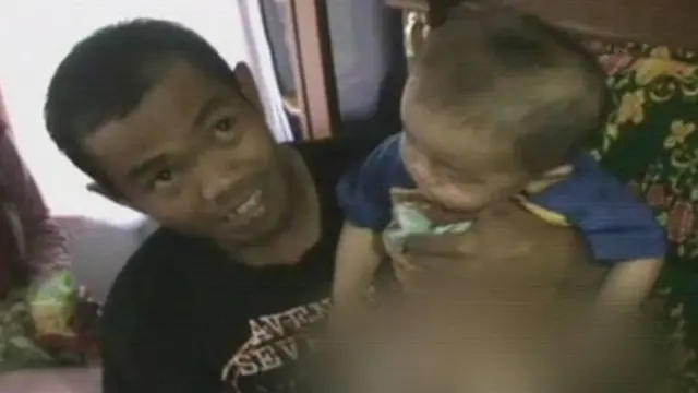 [VIDEO] Bayi di Garut Punya `Kelamin Ganda`