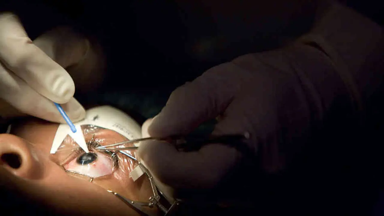 Lasik Boleh Dilakukan Ibu Hamil dan Menyusui