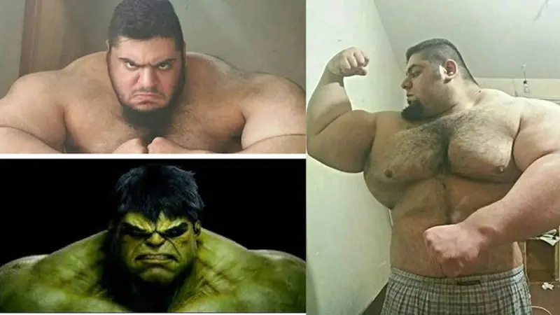 Hulk di Dunia Nyata Ternyata Ada, Ini Kisahnya