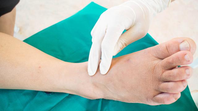 9 Ciri-Ciri Luka Diabetes yang Sering Disepelekan, Ketahui Penyebab dan Pengobatannya