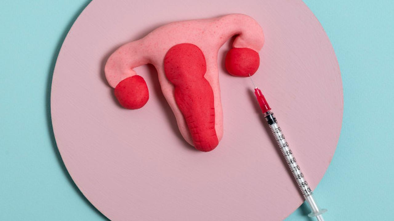 Jerawat Muncul Setelah Pasang IUD? Simak Penjelasan Ahli