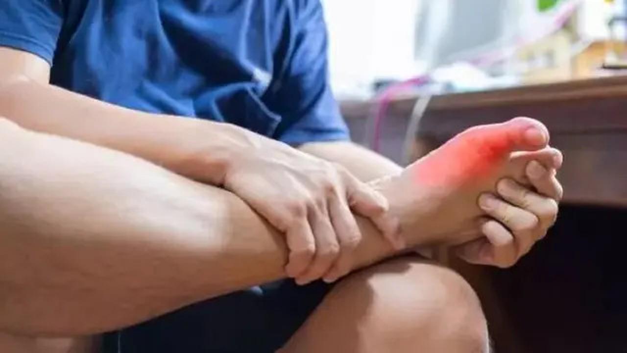 Cara Mudah Mengatasi Asam Urat di Rumah Hanya Dengan Es