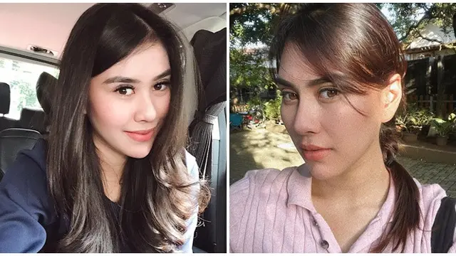 6 Perbedaan Wajah Syahnaz Sadiqah dari Sebelum Vs Setelah Dituding Oplas