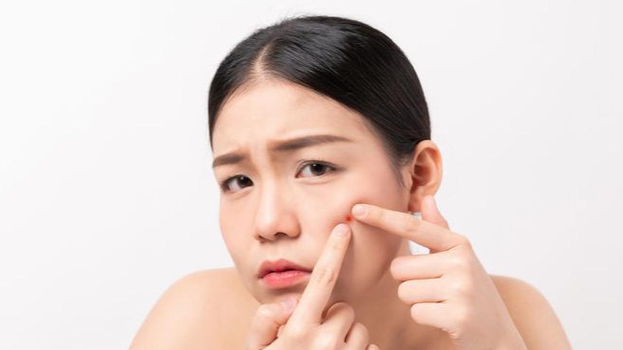 Punya Kulit Berjerawat? Ini Urutan Skincare Malam yang Paling Efektif untuk Hasil Maksimal dan Jerawat Langsung Kempes