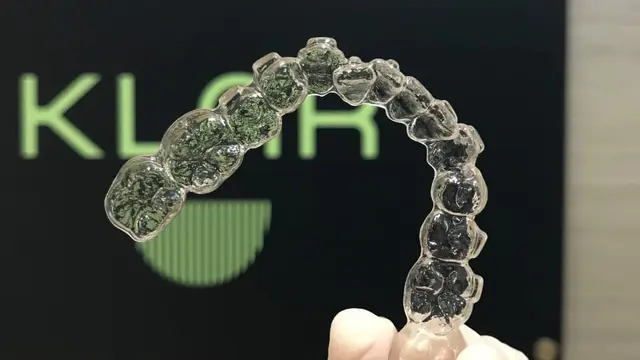 Inovasi aligner KLAR dikembangkan oleh ortodontis berpengalaman/dok. KLAR