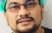3 Capres Punya Masalah yang Sama, Dokter Tompi Tawarkan Prabowo, Anies & Ganjar Operasi Ini