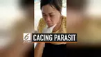 Wajah seorang wanita Vietnam dipenuhi puluhan cacing parasit. Dokter berhasil mengeluarkan cacing parasit yang diketahui telah berkembang biak.