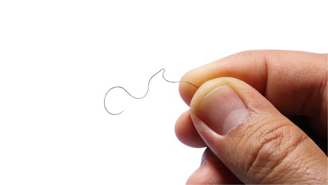 Ilustrasi bulu (iStockphoto)