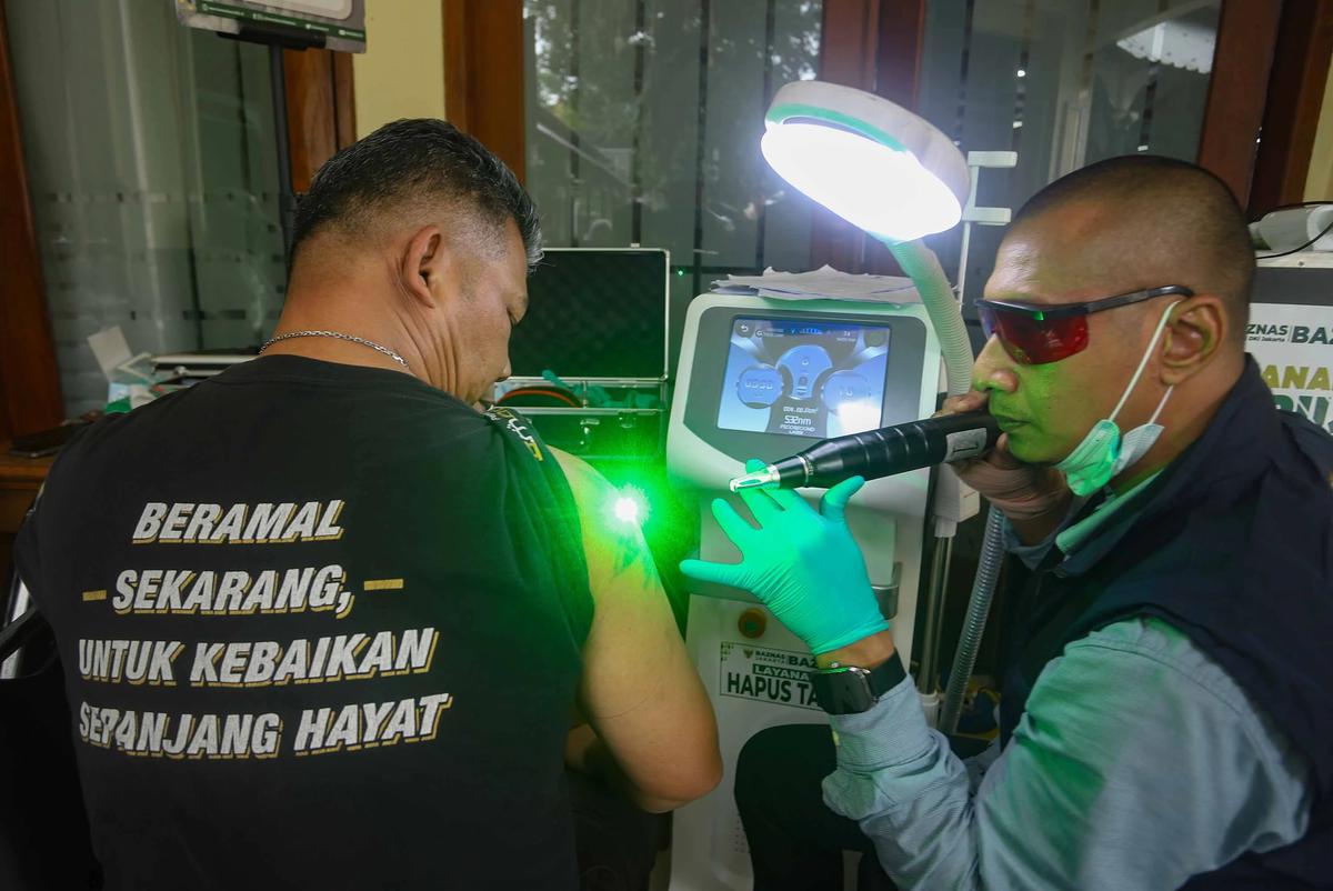 FOTO: Layanan Hapus Tato Gratis Sambut Ramadhan di Jakarta