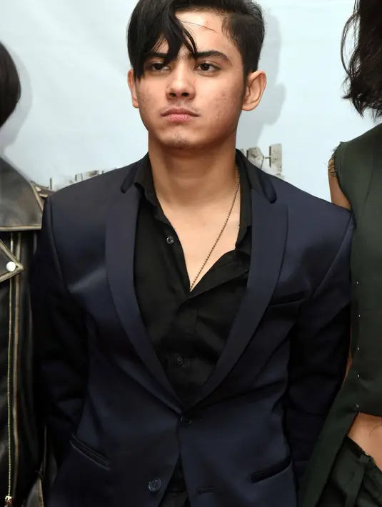 Ia menceritakan mengenai kejadian yang baru saja dialaminya. Sebuah kecelakaan kecil saat di kolam renang. Yang membuat kaki kirinya robek hingga mendapat jahitan. (Nurwahyunan/Bintang.com)