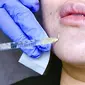 Generasi Z kerap gunakan filler untuk mengubah bentuk hidung, dagu, dan bibir. (Dok. Liputan6.com/Dyra Daniera)