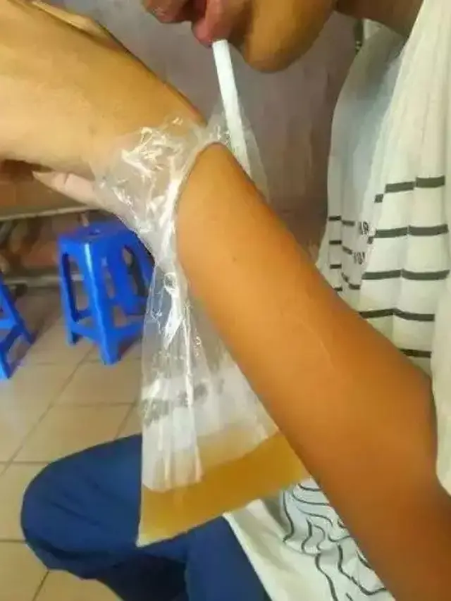 6 Lifehack Minum Es Teh di Plastik Ini Bikin Geleng Kepala