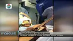 Sambil memetik gitarnya di meja bedah, Prasad dapat merespon langsung perbaikan yang dilakukan para dokter.