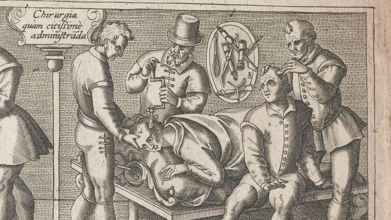 Trepanasi