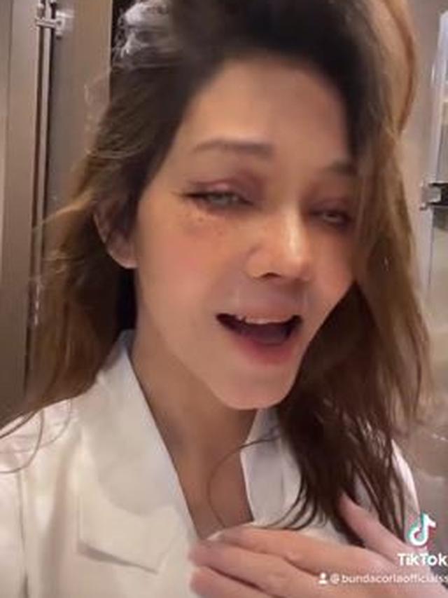 Bunda Corla Operasi Plastik, Ini 6 Potretnya dengan Perban dan Wajah Lebam