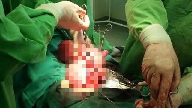 Dikira Hamil, Dokter Malah Menemukan Hal Mengerikan Pada Tubuh Wanita Ini