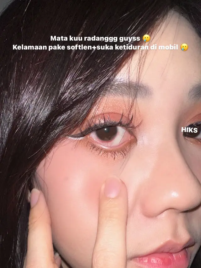 Instagram Story Jessica Jane yang memperlihatkan kondisi matanya yang memerah